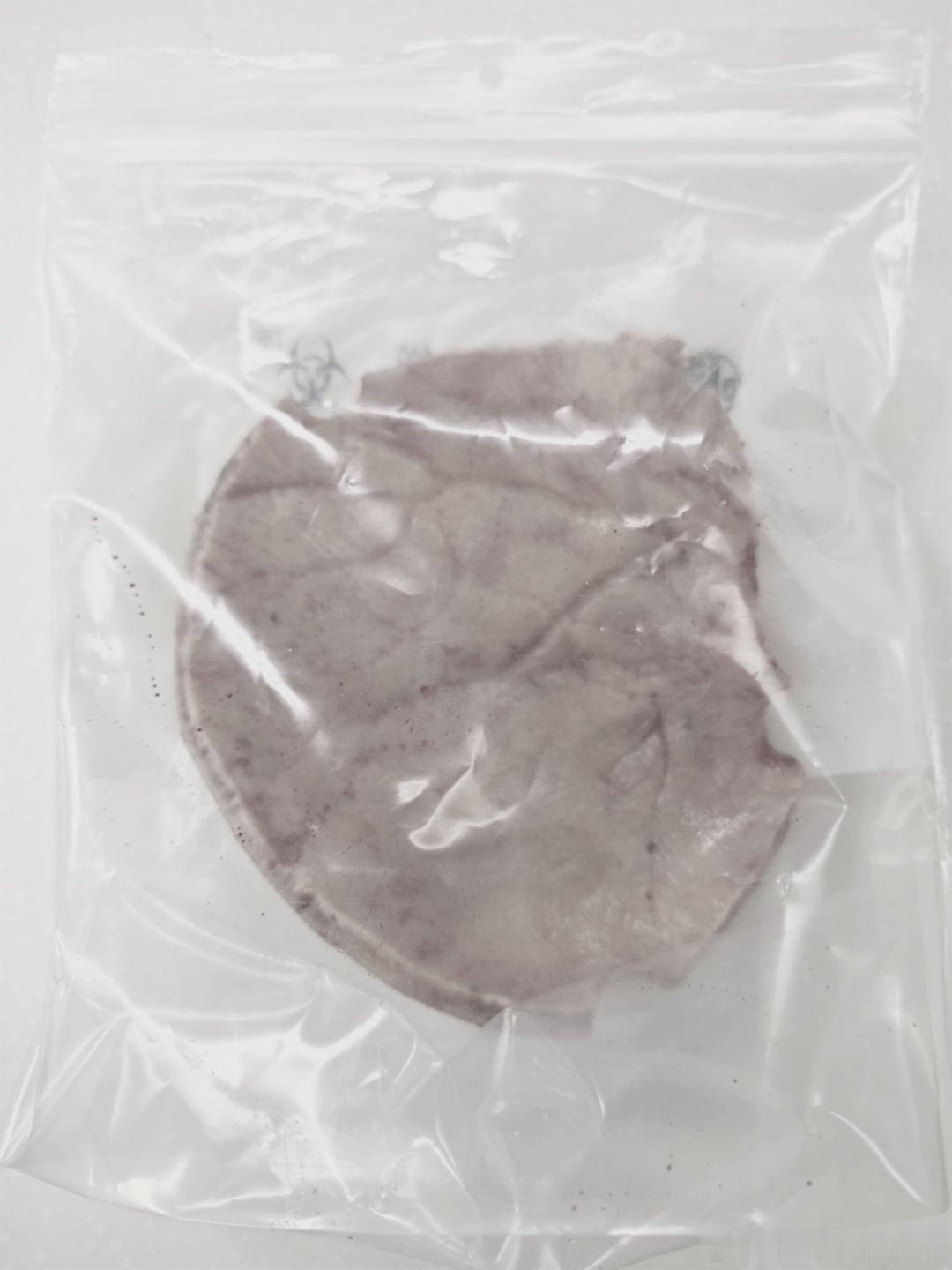 这个夜班是真的累到了，一秒钟都没有睡到，刚刚把病人护送到icu去。有一种精疲力尽