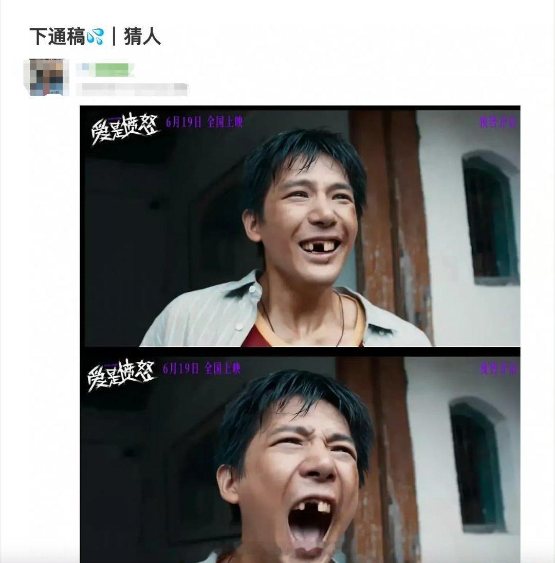 王安宇爱是愤怒掉了两颗牙王安宇新电影形象扮丑被豆瓣热议……好好一张脸搞这样 王安