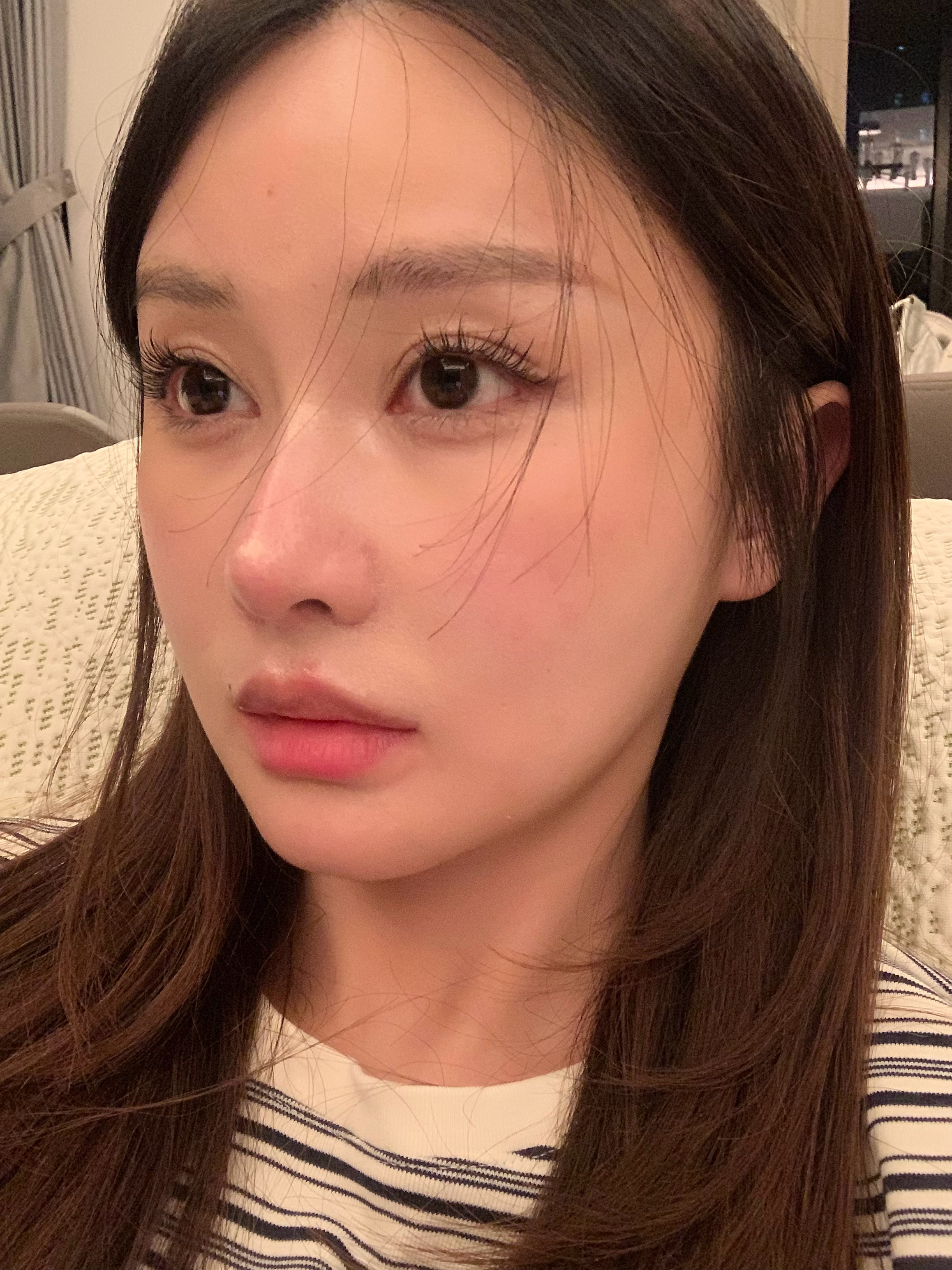 关于轻薄针的频率，一直跟大家说的是 前期打频繁一点，后期就可以慢慢拉长时间了，效