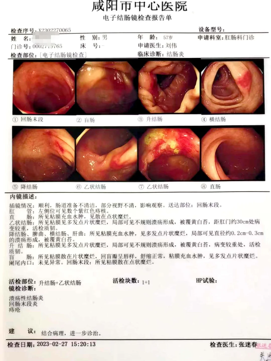 炎症性肠病的治疗贵在坚持。