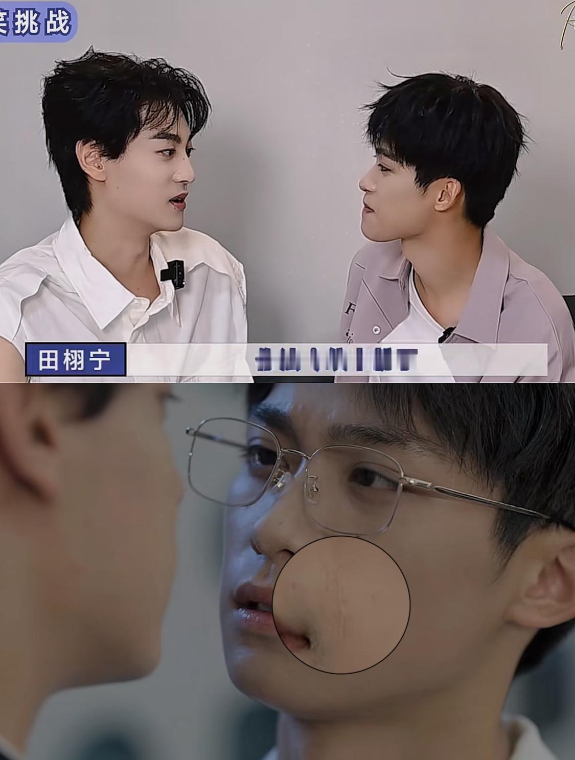 原来是真的
梓渝宝宝太爱笑了 笑多了法令纹就会积线 本人也是这样哈哈