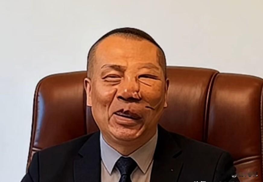 视力降到0.1，他撕掉手术单，赶回排练厅。
安万刚查出左眼几乎失明，右眼正常，面