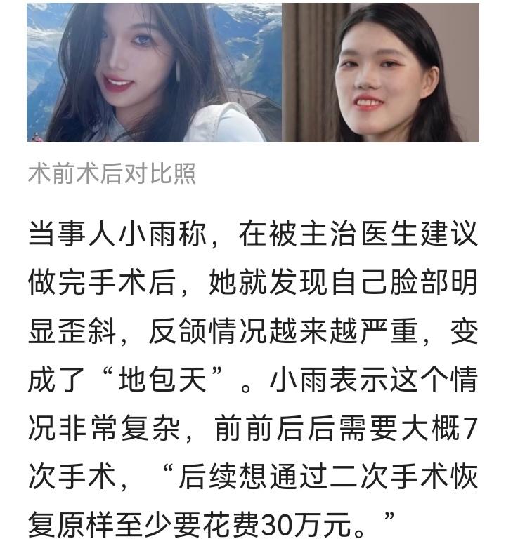 医院给做反了！轻微地包天变成“鞋拔子脸”。武汉大学口腔医院发通报，医生已停诊（详