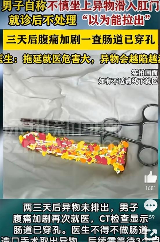男子肛门滑入异物忍3天后肠道穿孔，这事儿发生在广东深圳，一中年男子自称因“不慎坐