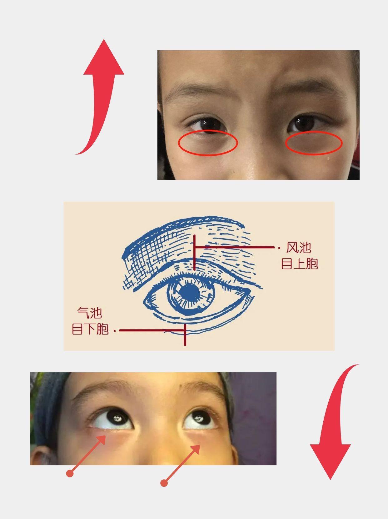 孩子脾胃好坏，看这个地方就知道了！
 
中医认为：脾主运化，脾虚的孩子易出现反复