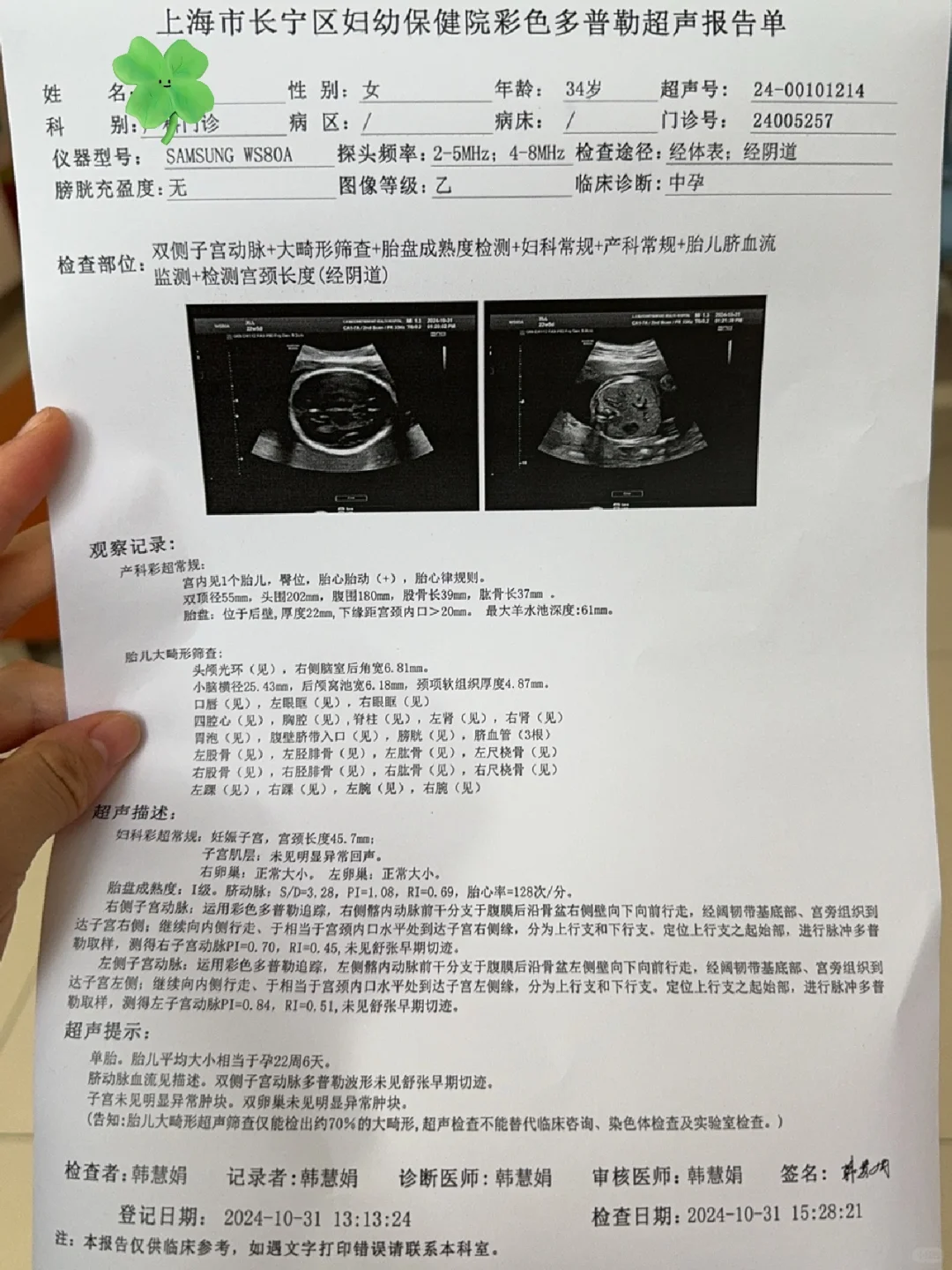 大排畸！逆子让我熬走了长妇幼所有的孕妇！
