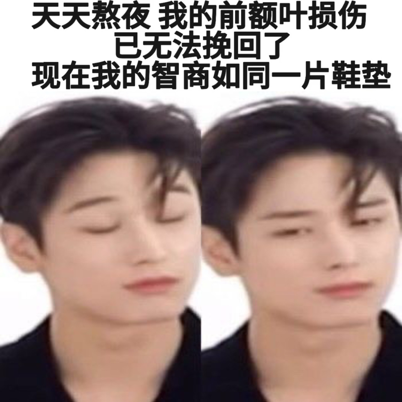 这种呆傻的孩子长得都一样，大眼睛，高鼻梁，表情都差不多。你是中药西药怎么开发他都