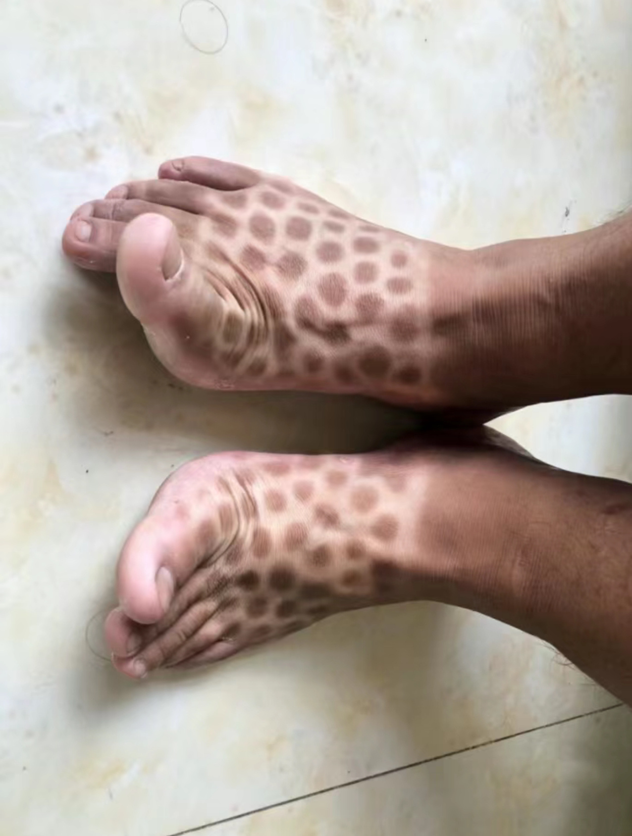 怪不得看不到云南人穿洞洞鞋 ​​​