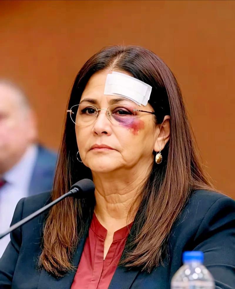 委内瑞拉炸出重磅猛料！美国把人家第一夫人扣在牢里，都快熬出心梗了还死活不肯松口放