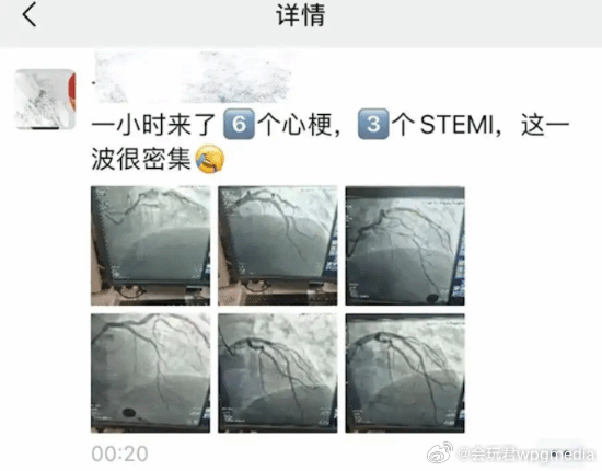 三甲医院专家感慨1小时6个心梗：三四十岁发病率走高据国内媒体报道，4月6日凌晨，