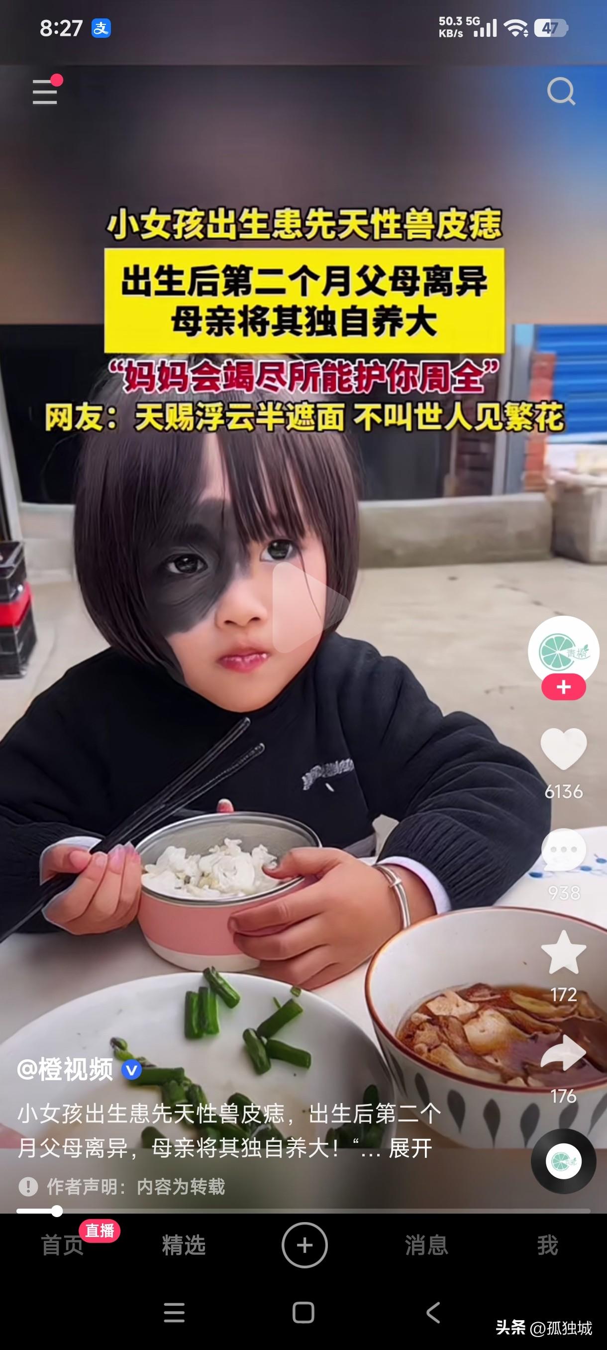 小女孩出生就患先天性兽皮痣，出生后第二个月父母离婚，母亲独自将她抚养长大，这先天