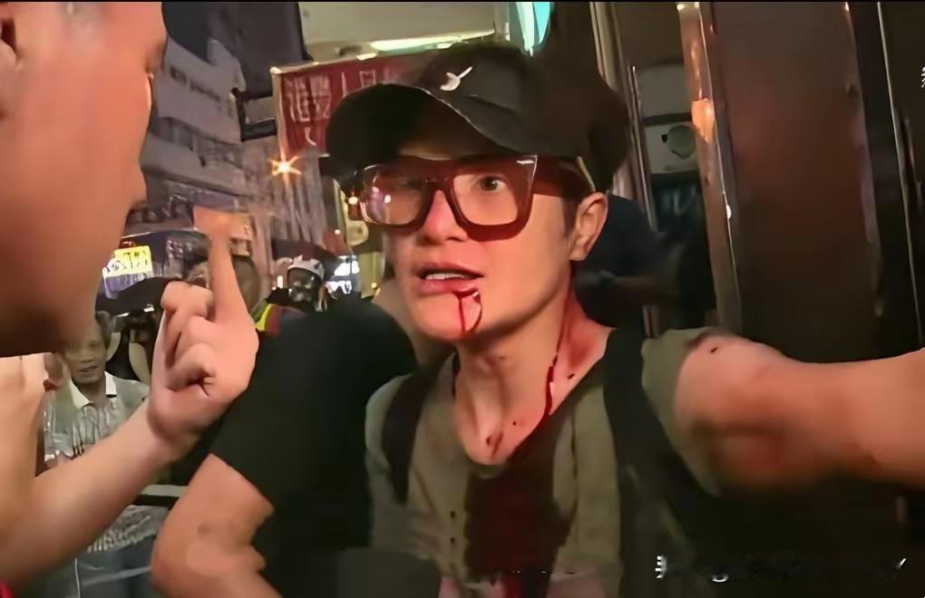 这事儿真是越想越憋屈！​TVB那个经常演丑角的马蹄露，最近发公开信硬刚张敬轩了。