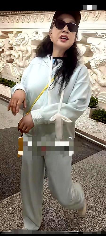 75岁的刘晓庆录节目，在贵州探溶洞时摔骨折了。

胳膊打着石膏，她转头就去重庆继