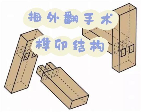 关于拇外翻手术中的榫卯结构提示