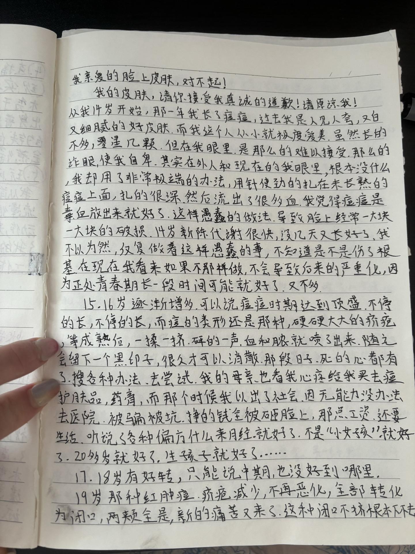 十年痘皮的经历希望能给大家帮助。