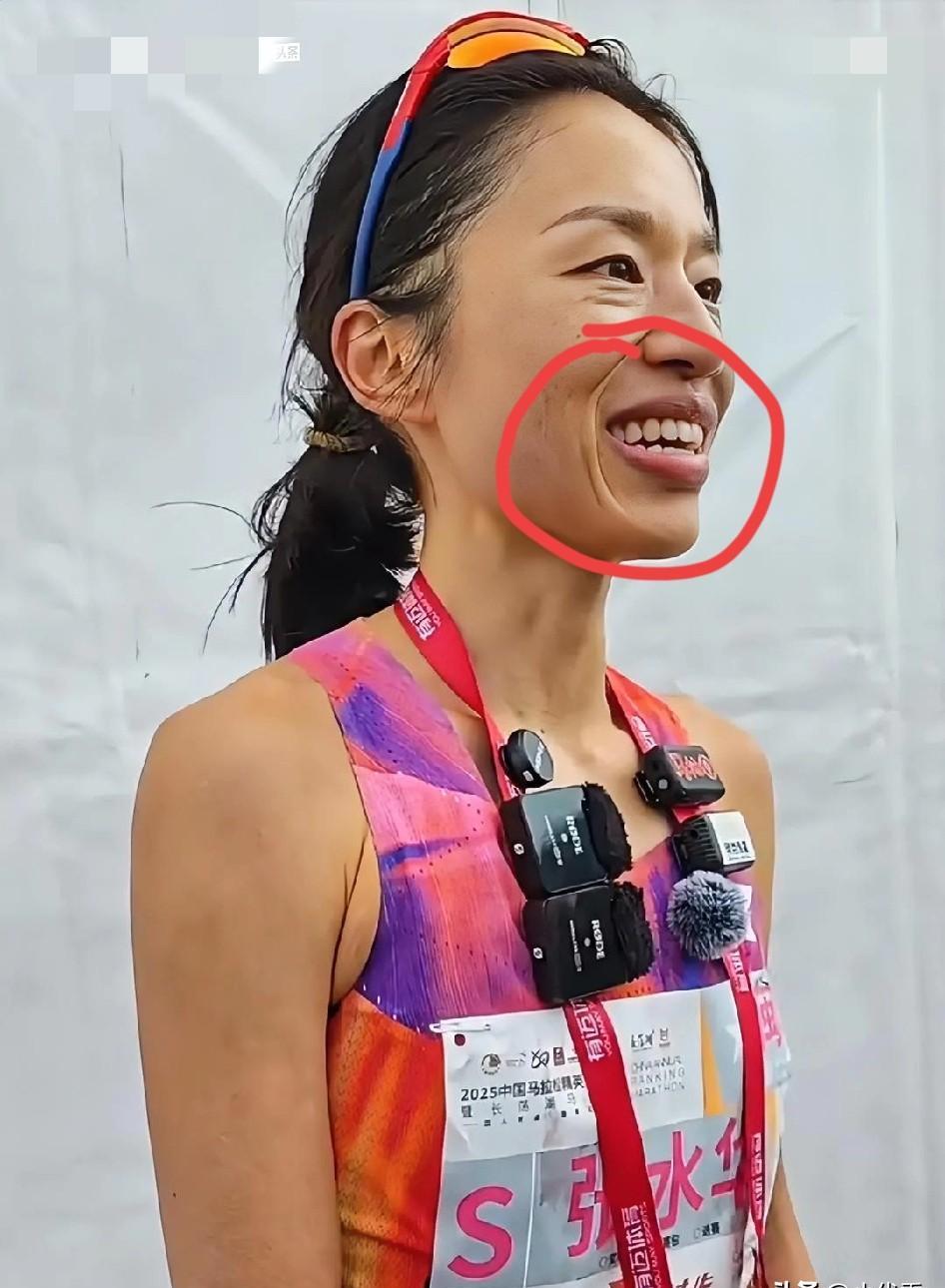 34岁运动员被嘲“像50岁”？
别骂他不保养——这才是职业体育没人敢说的真相！