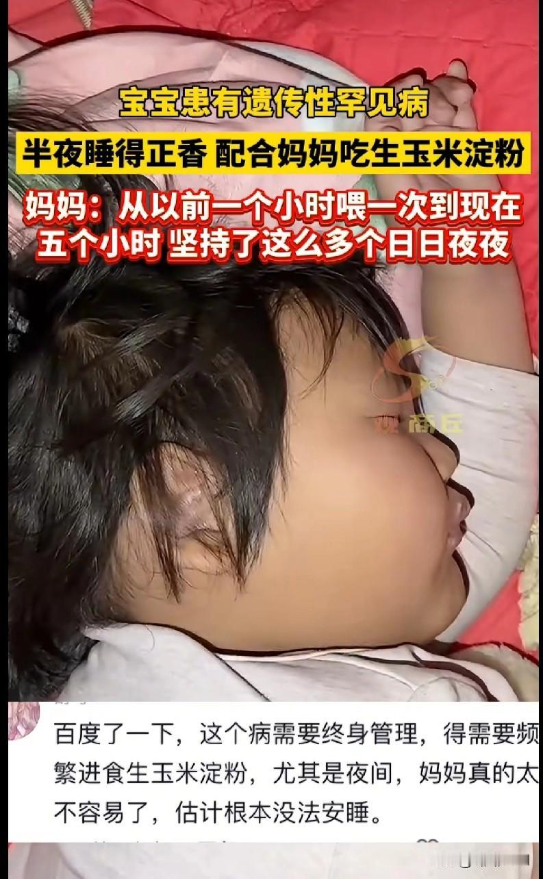 家人们，刷到这个真的泪目了！宝宝患遗传性罕见病，半夜睡得正香，还得配合妈妈吃生玉