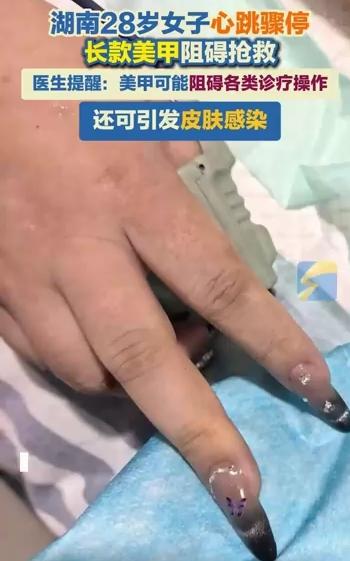 心脏骤停，美甲阻碍抢救！

湖南一28岁女子心跳骤停，医生抢救时却遇到了阻碍，因