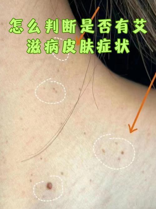 8旬老人与保姆发生关系感染HIV！老年HIV感染暴增3倍，这些误区害了太多人
 