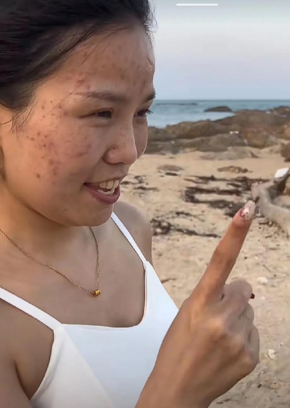 偶遇网红拍视频，其实都是普通人，姐妹们不要容貌焦虑了。
网络直播也应该出个素颜直