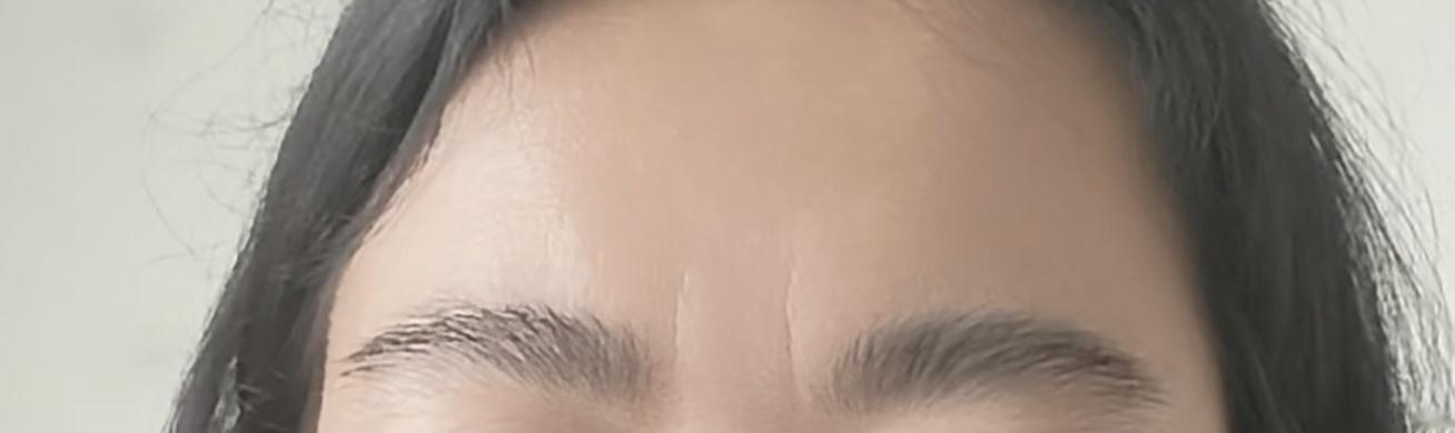 即使美颜，也遮不住印堂的纹路与法令纹，还是长短不一的法令纹。 