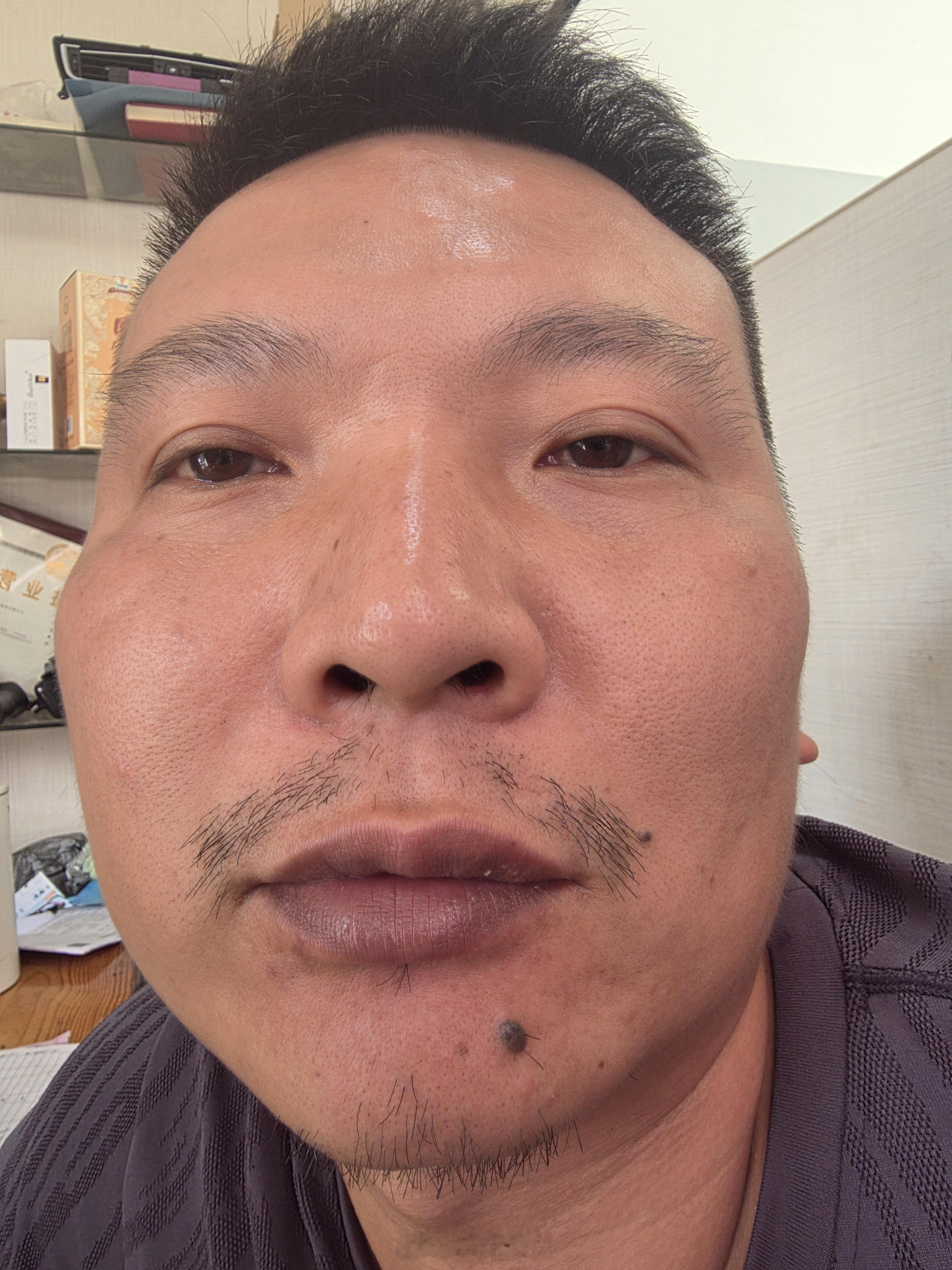 这个嘴唇到底算不算黑？？？ 