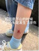 5月9日网易新闻发布，好人没好报？五一期间，一女子带女儿游玩时孩子不慎刮伤腿，景