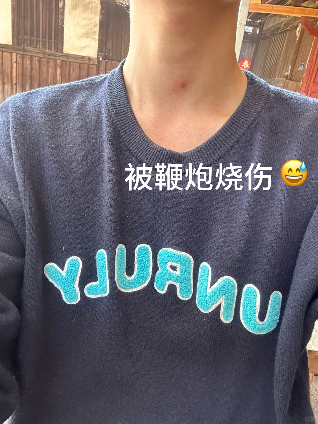 长乐游神 受伤者来发个声❗️