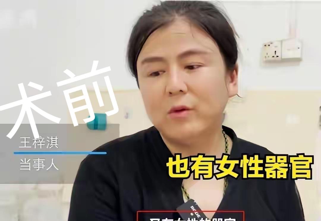 两性人肯定能生孩子
20年前就有报道，一男人已结婚生子，他到南方打工，去做了切除