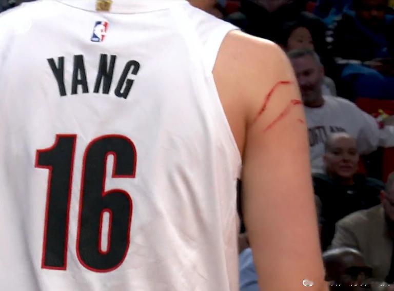 杨瀚森胳膊两道血印 转播镜头给了杨瀚森的胳膊一个特写，两道大血印，对抗真是激烈 