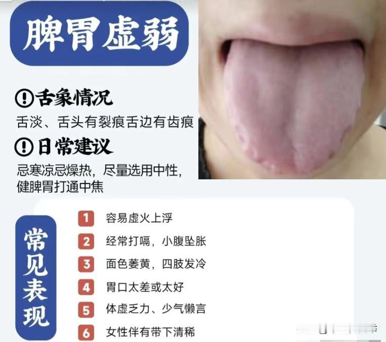 身体有病，舌先知，阳虚、寒湿、湿热、上热下寒、脾胃虚弱，你是哪一种？快来对照一下