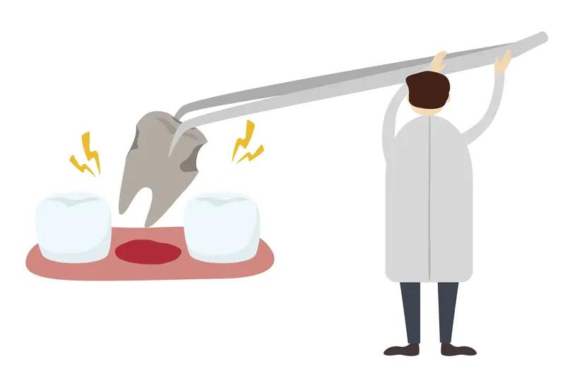 1月13日江苏苏州，三甲医院拔牙，把两公斤的棉花缝进伤口里，疼到我每天吞4颗止痛