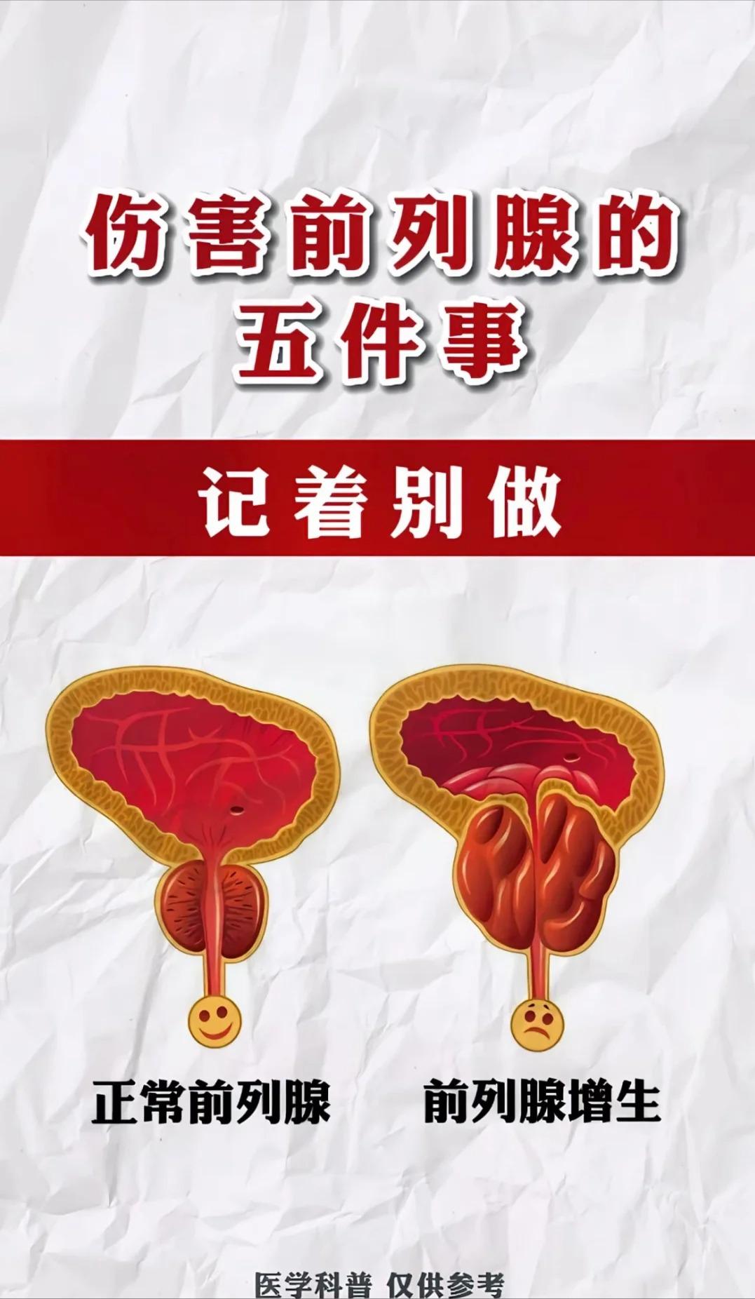 伤害前列腺的5件事，千万不要做！