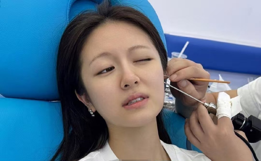 我丢...李兰迪这素颜。。 