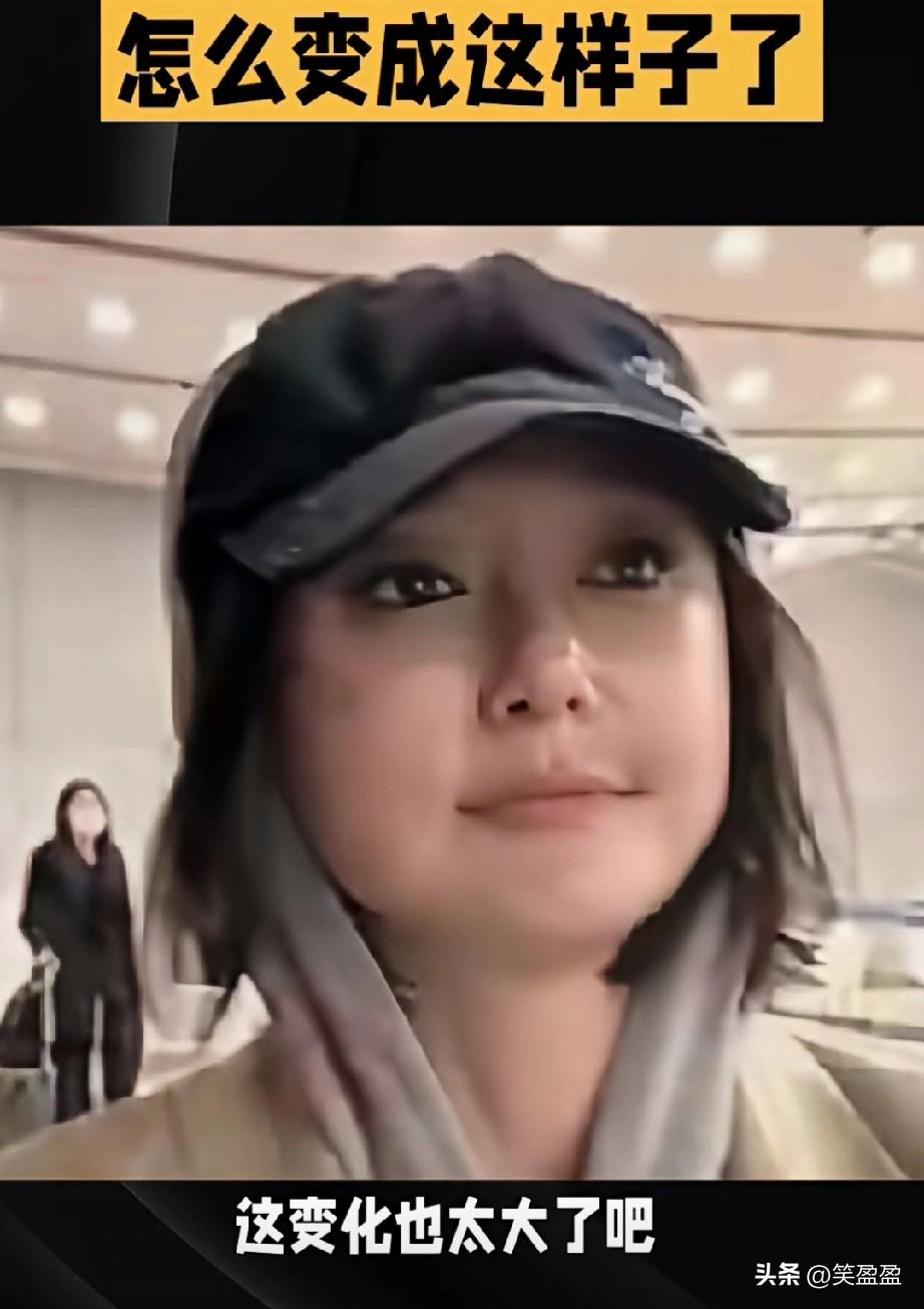 我的天呐，
这变化也太大了吧，
完全认不出来了，是医美过度了吗？以前多自然好看，