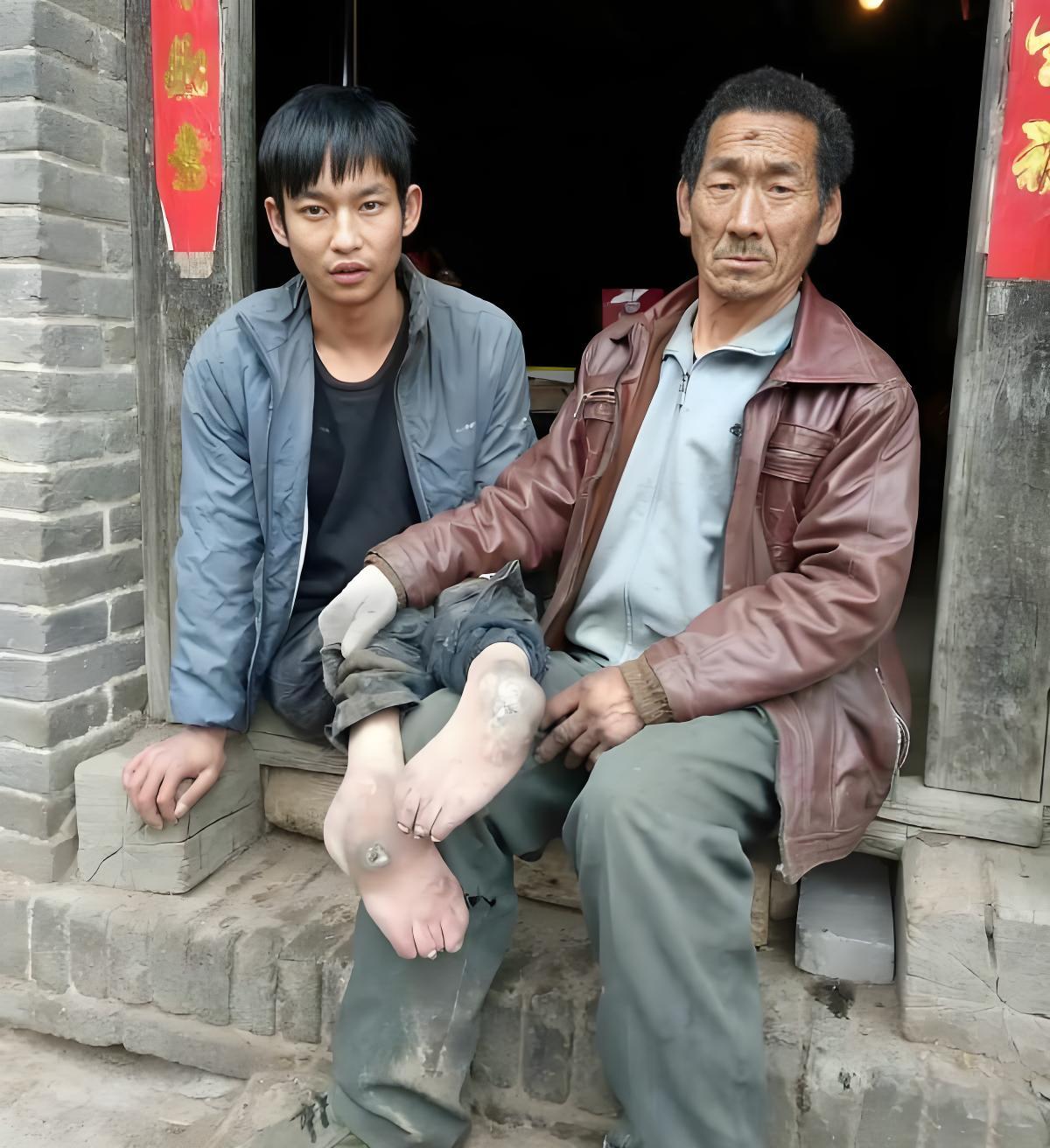 1991年，河南一对夫妻生下一残疾儿子，无力抚养，狠心将其遗弃在草丛里，谁料，竟
