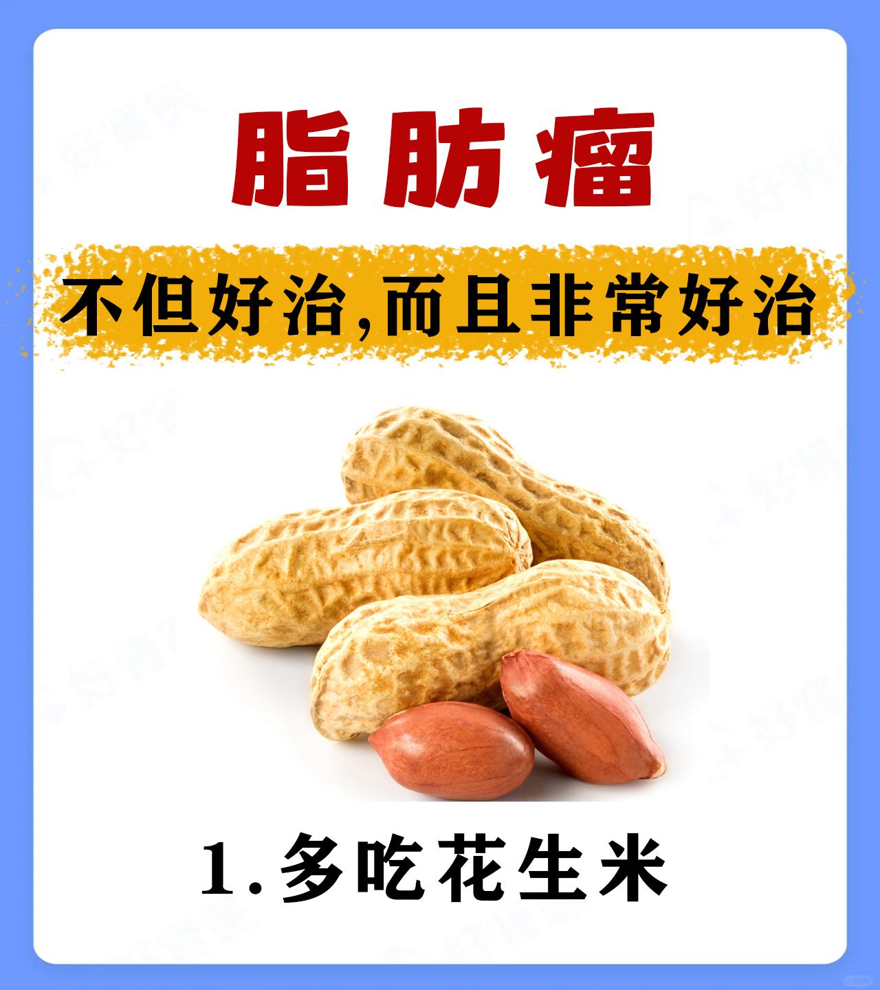 脂肪瘤的10条小知识