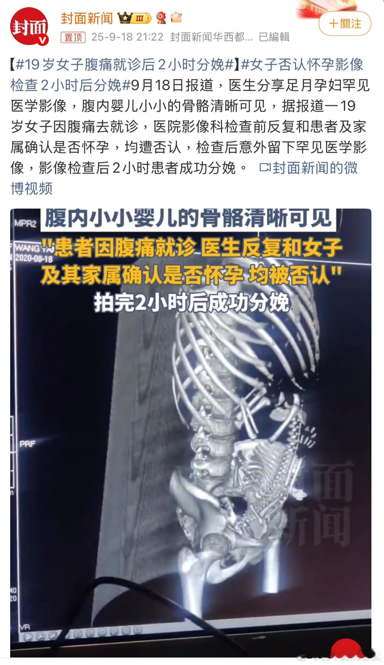 19岁女子腹痛就诊后2小时分娩 腹痛就医竟在2小时后分娩，夏天衣服这么薄，孕肚怎