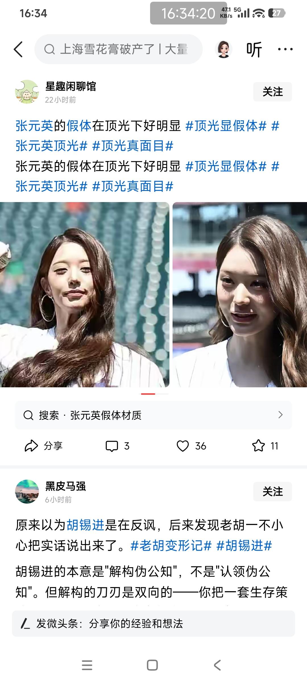 网友：张元英的假体在顶光下好明显！

这个张元英从不承认自己有植入假体。

张元