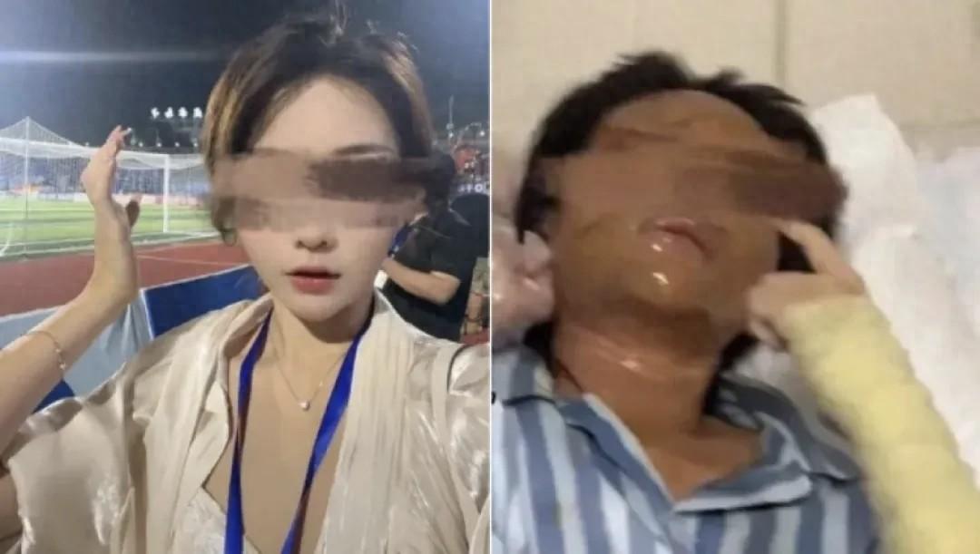 从网红惨遭杀害，到女主播被粉丝恶意报复炸伤毁容、事业尽毁！近期多起主播受害案曝光
