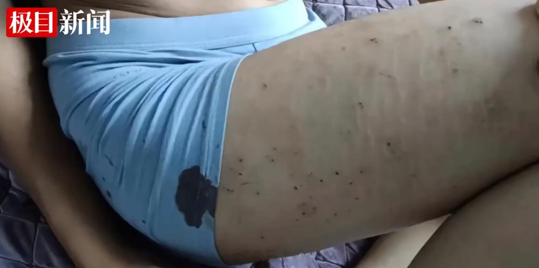 #警方回应男生大腿被同学用圆规扎出血# 当未成年人保护法，保护不了善良的孩子，却