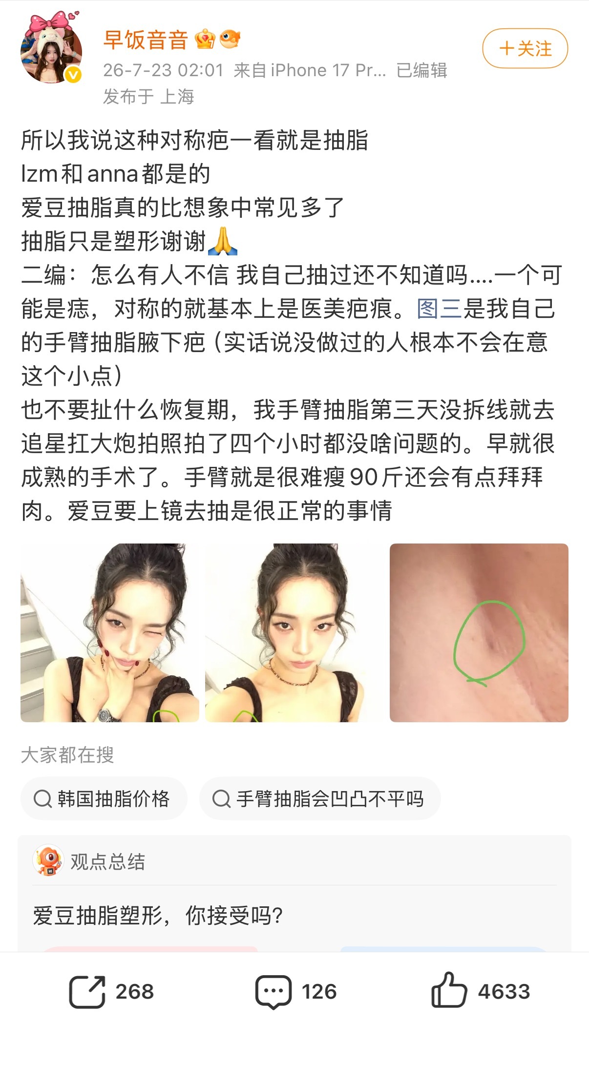 上半身都抽了为什么不把大腿抽一下 