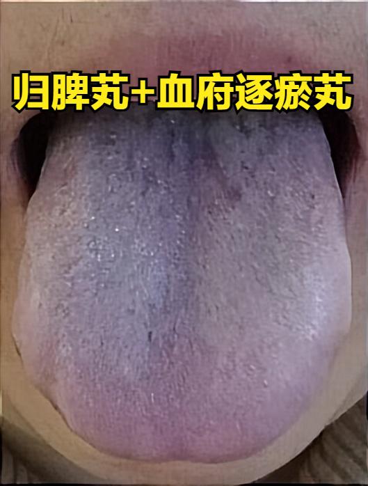 把归脾芄用好了，脾胃强了，痰湿、瘀血少了，气血自动充盈全身！

1.归脾芄+血府