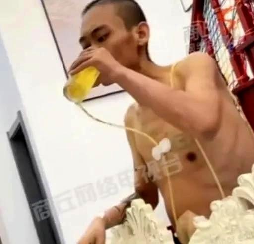 画面显示，这个叫张伟的男子，身上插着氧气管，手里端着啤酒大口喝着。
2023年的