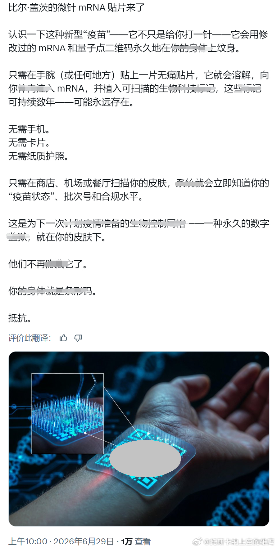 分享资讯：大门的微针贴片喵喵也是IOB“申联网”的组成部分，如果有形态类似的科技
