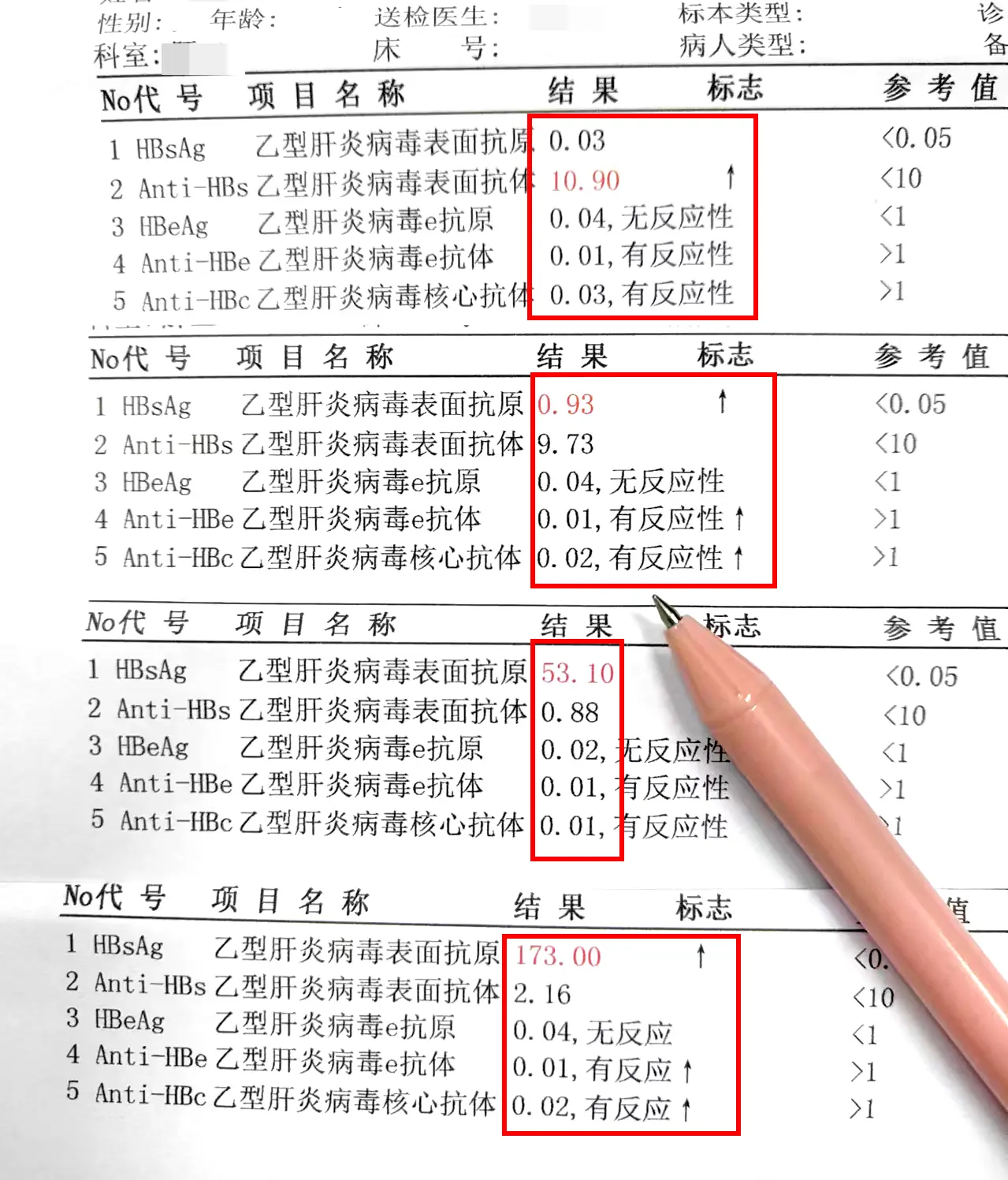 乙肝肝衰竭，十年 “生死较量，终实现乙肝临床治愈 这是我的一位老朋友...