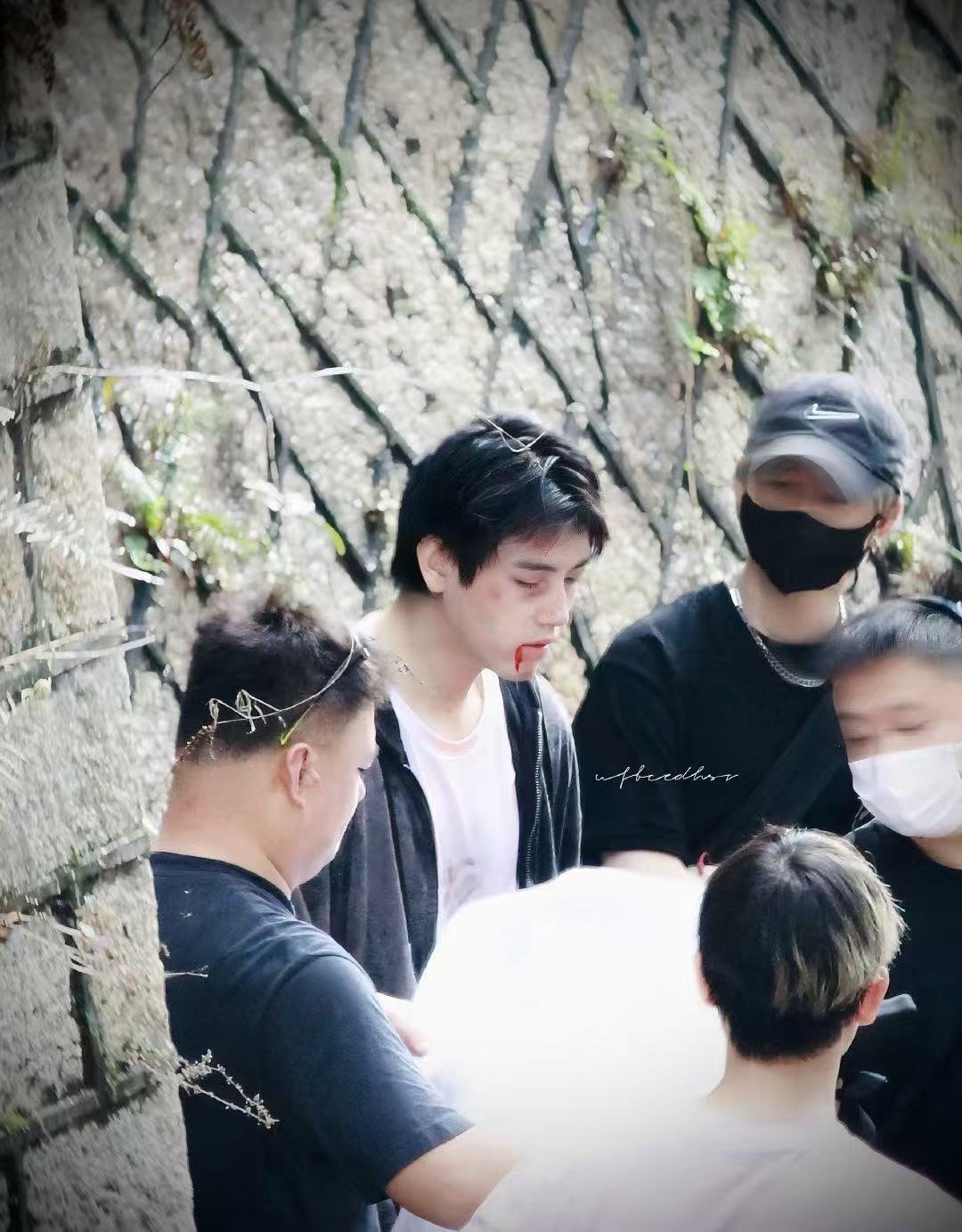 以为陈飞宇挨打了以为陈飞宇被打了 视觉欺骗天花板！陈飞宇受伤妆以假乱真，瞬间自带