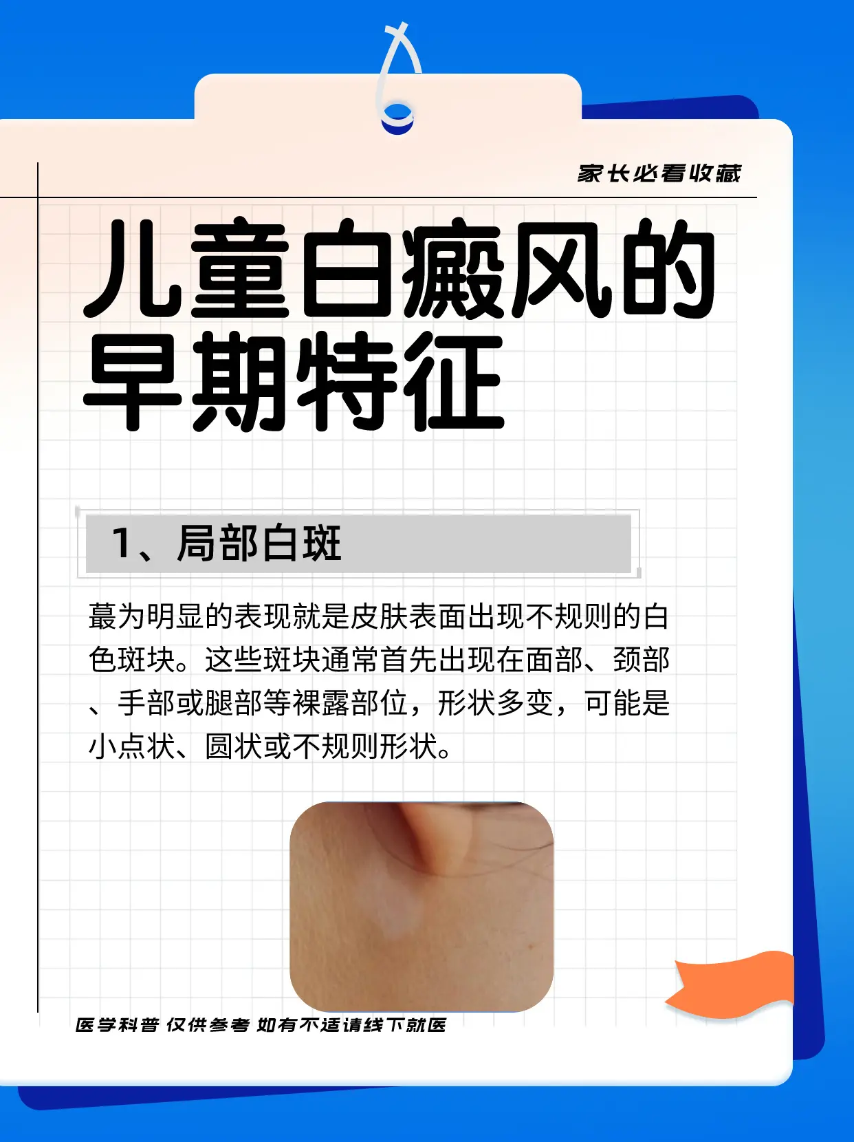 医学科普 白癜风 白癜风科普 硬核健康科普行动  白斑