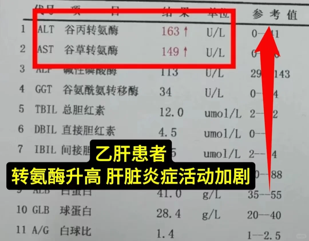 转氨酶多高需要治疗？