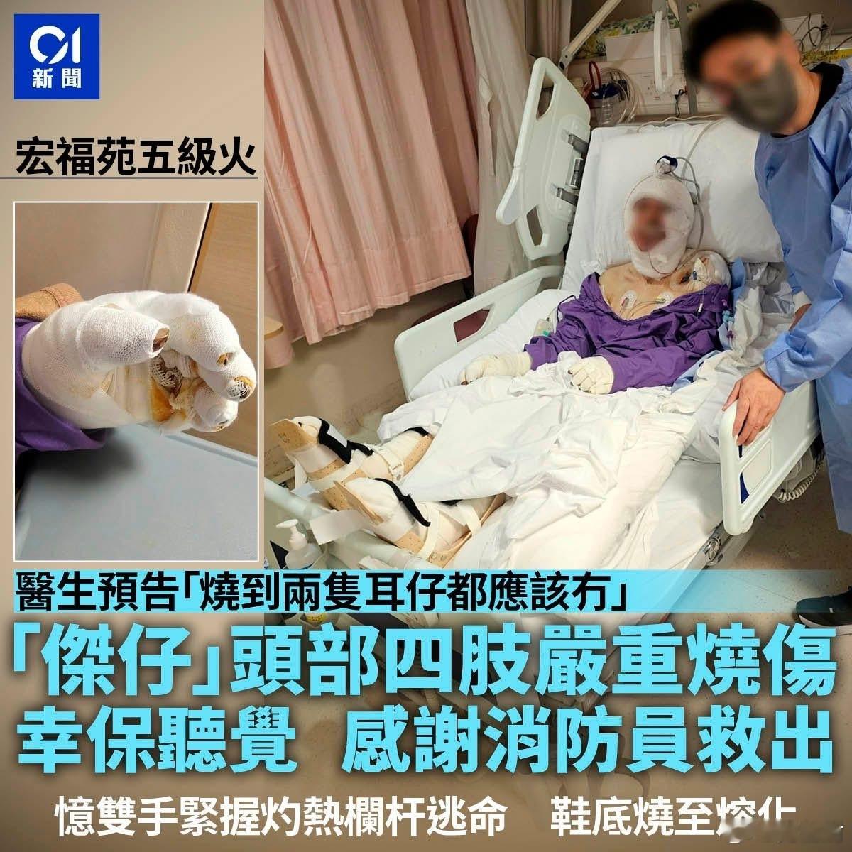 宏福苑五级火| 伤者「杰仔」恐失双耳幸保听觉　火海逃生谢消防大埔宏福苑五级大火灾